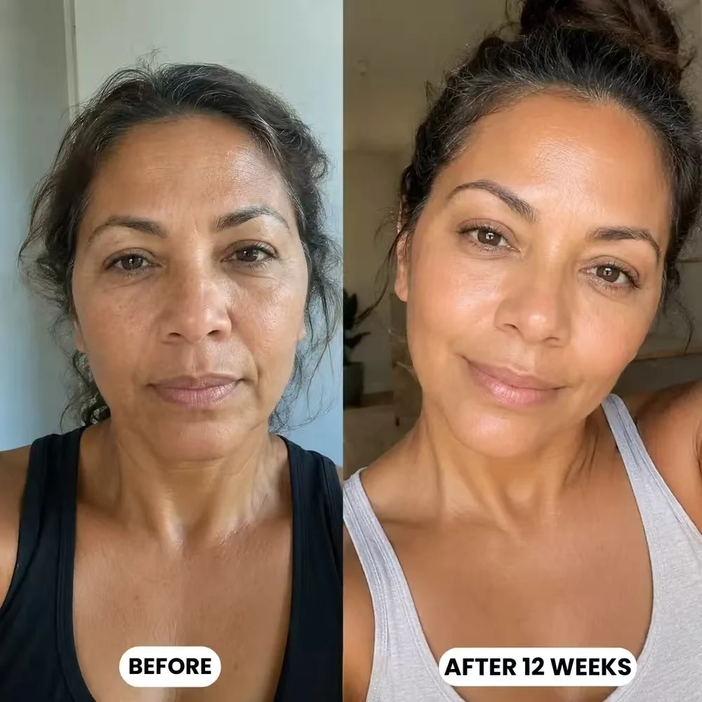 Customer before and after 12 weeks of silkcolla collagen mask