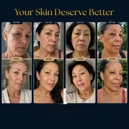 Customer before and after photo grid
